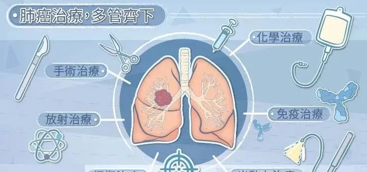 肺癌的治療選項(xiàng)有哪些？